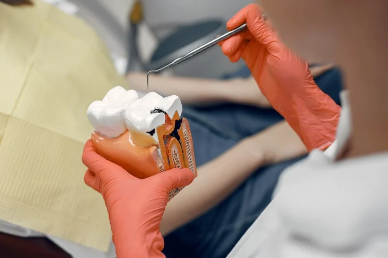ENDODONTICS (Root Canals)